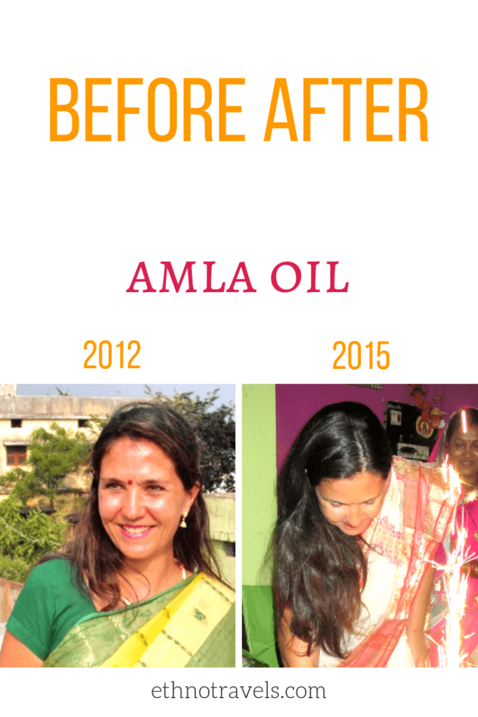 Amla Oil For Hair Growth And Thickness Ethno Travels