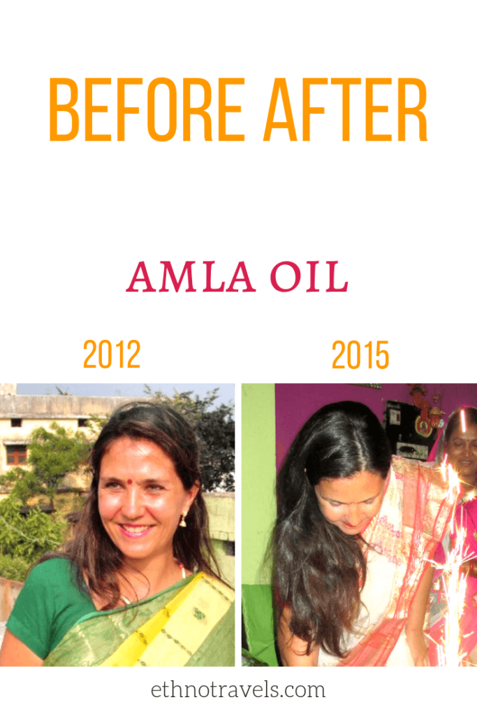 Amla Oil for Hair Growth and Thickness: best brand reviews ...