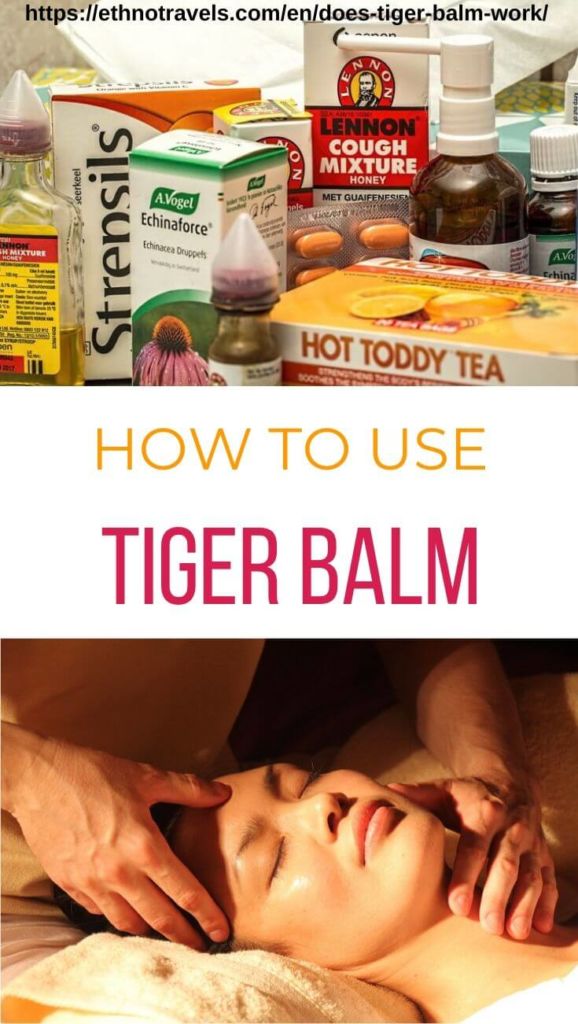 Does tiger balm work